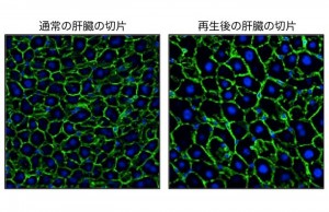 肝細胞の核(青色)と輪郭(緑色)を可視化した。肝再生後の肝細胞(右)は、平常時の肝細胞(左)に比較して顕著に大きくなっていた。© Yuichiro Miyaoka 肝細胞の核(青色)と輪郭(緑色)を可視化した。肝再生後の肝細胞(右)は、平常時の肝細胞(左)に比較して顕著に大きくなっていた。© Yuichiro Miyaoka
