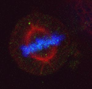 メチル化HSP70とAurora kinase Bは核内で共局在する © Ryuji Hamamoto