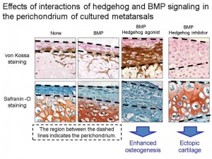 © Hironori Hojo. Effects of the interaction of hedgehog and BMP signaling on bone and ectopic cartilage formation in the perichondrium. When hedgehog signaling was activated, activation of BMP signaling enhanced bone formation. On the other hand, when hedgehog signaling was suppressed, activation of BMP signaling induced ectopic cartilage formation instead of bone formation. © Hironori Hojo. Effects of the interaction of hedgehog and BMP signaling on bone and ectopic cartilage formation in the perichondrium. When hedgehog signaling was activated, activation of BMP signaling enhanced bone formation. On the other hand, when hedgehog signaling was suppressed, activation of BMP signaling induced ectopic cartilage formation instead of bone formation.