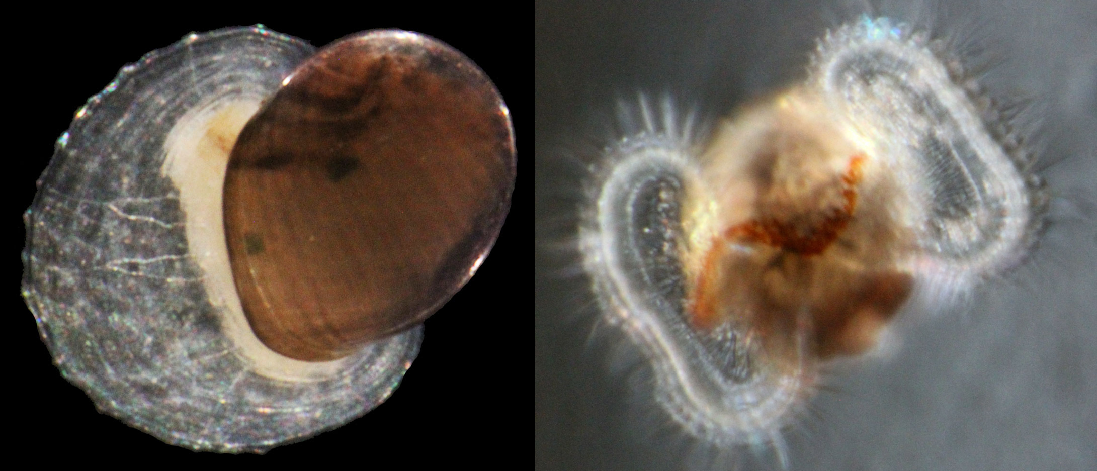 Brown cellular shapes surrounded by a clear jelly like substance